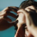 atasi jerawat batu di dahi dengan cara yang benar